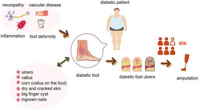 The role of machine learning in advancing diabetic foot: a review